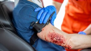 STOP THE BLEED Applicazione del Tourniquet